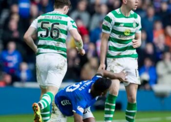 Diverstating: celtic loan player banned after breaking opponent’s leg